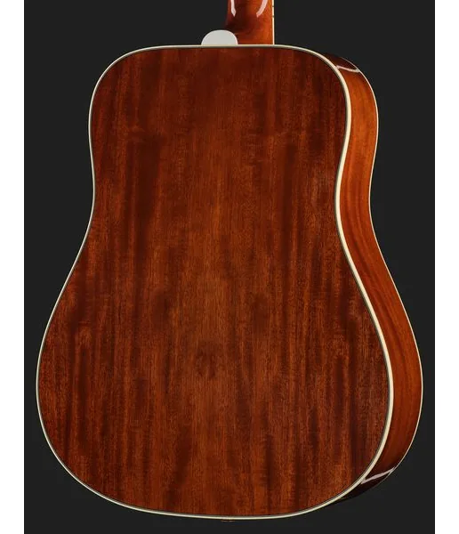 Gibson Hummingbird Anniversary Ltd CB detail 5