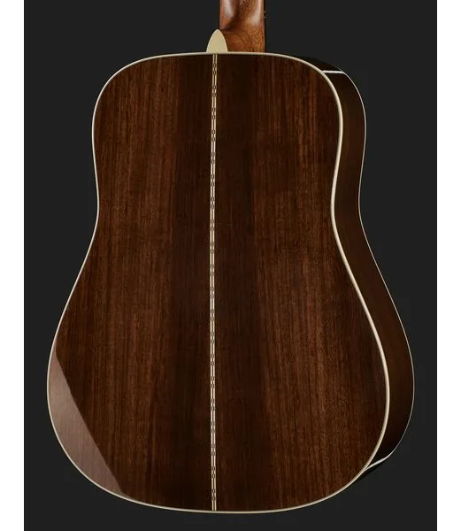 Martin Guitar D-28 Sunburst detail 5